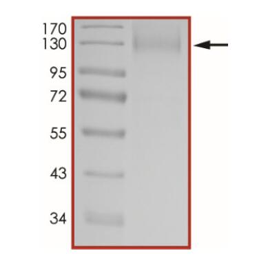 The purity of nCoV-S1 (Δ69-70) was determined to be >90% by densitometry